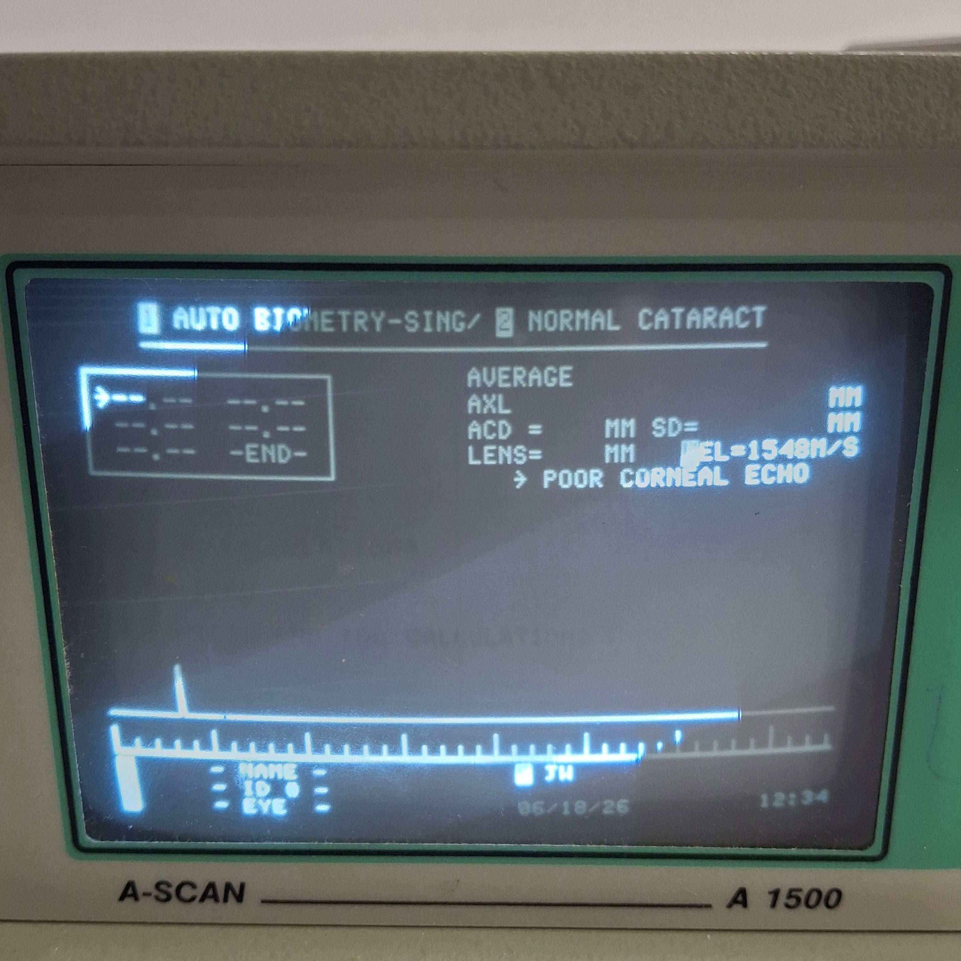 Sonomed Escalon A-Scan A 1500 Ophthalmic Ultrasound