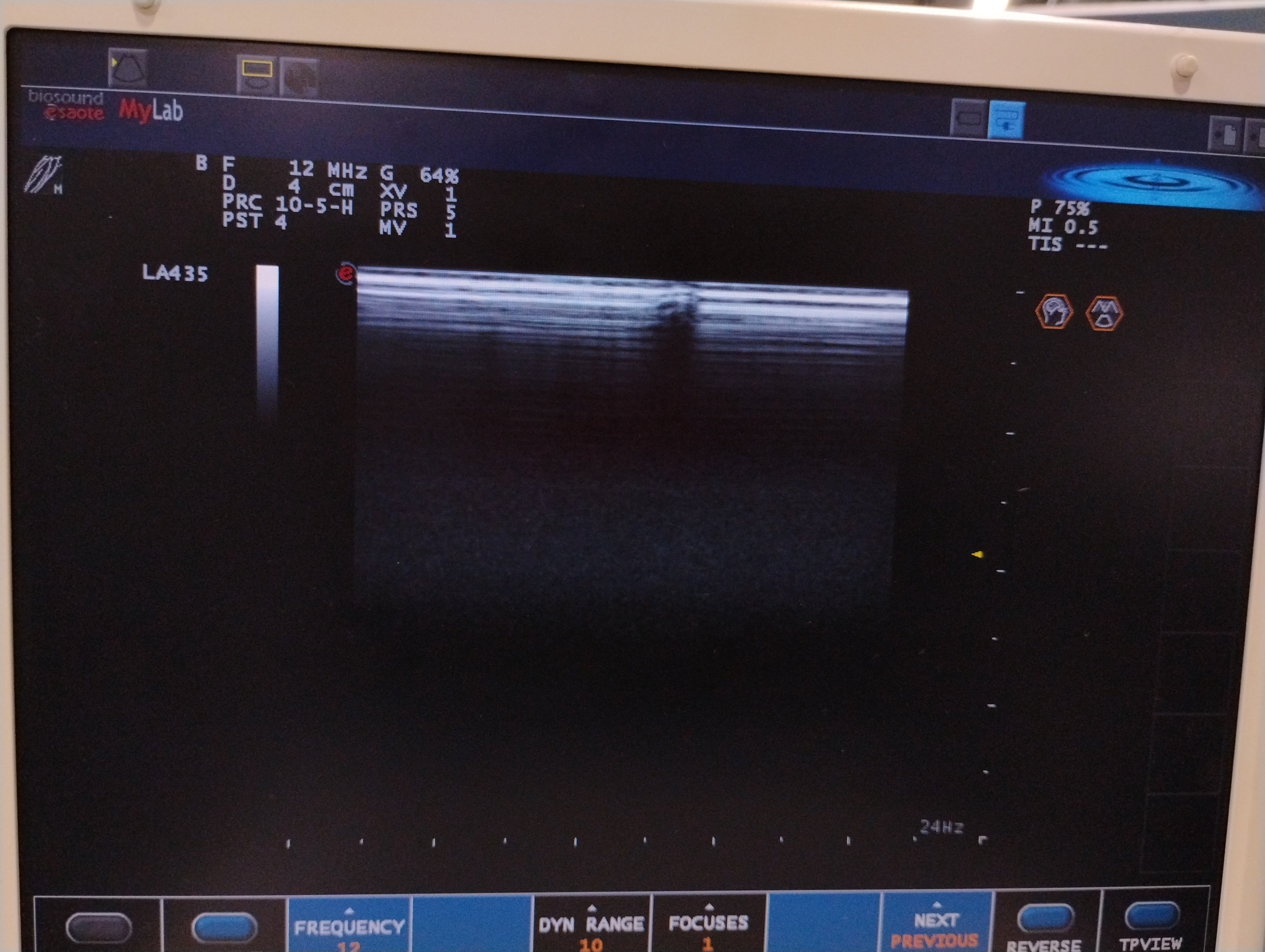 Esaote BioSound 411410 MyLab Five Ultrasound